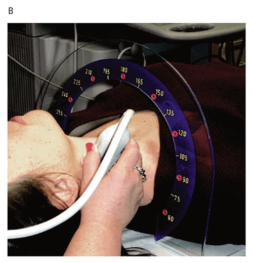 Fig B:  : This image illustrates the ultrasound testing method used in the study.